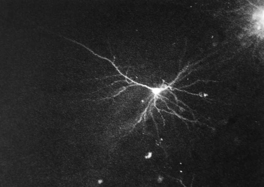 De Stefani - reazione nera